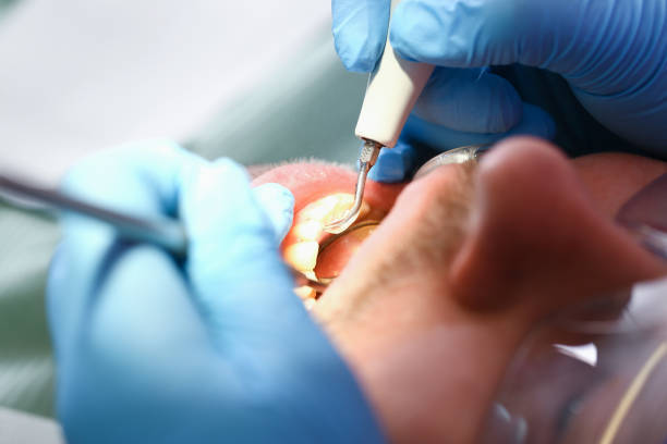 Best Cracked Tooth Emergency Dentist  in Clifton Knolls Mill Creek, NY